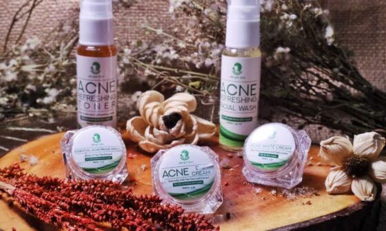 Kenali Penyebab Jerawat dan Produk Penghilang Bekas Jerawat Terbaik untuk Wajahmu 6 Penyebab dan Cara Menghilangkan Jerawat-eBrightSkin Acne Care 3 (1)