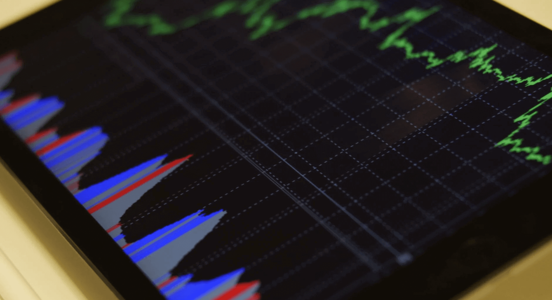 Investasi saham